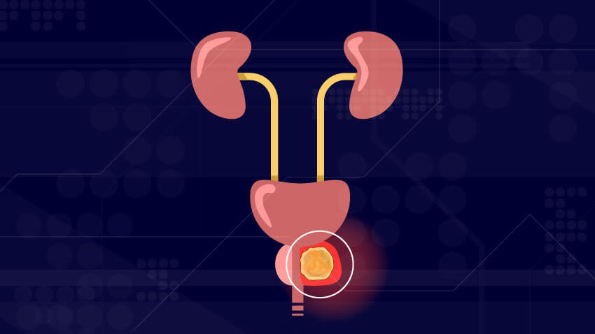 پروستات چیست